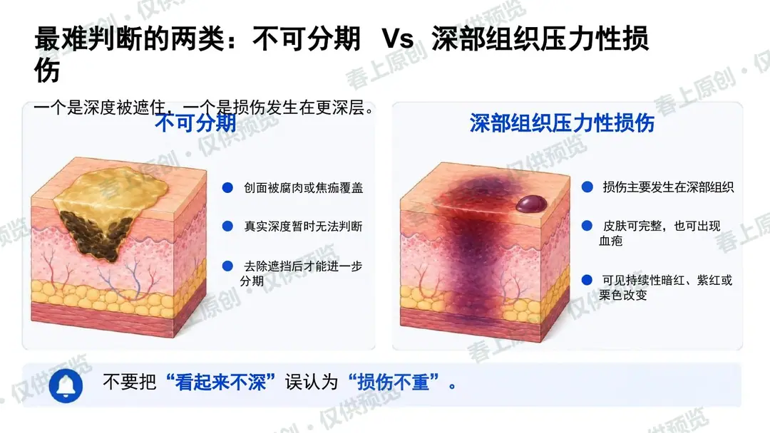 压力性损伤预防与护理管理预览第23页