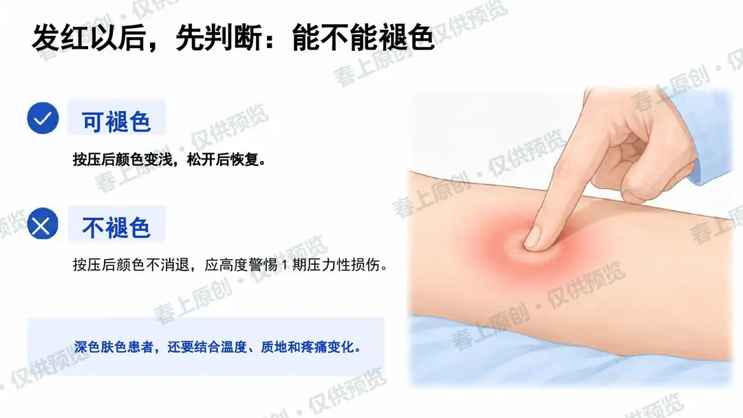 压力性损伤预防与护理管理预览第9页